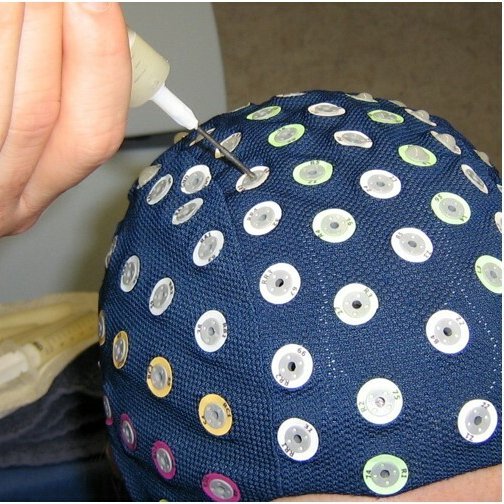 Befüllen einer EEG Kappe mit Leitgel